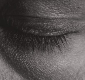 emdr